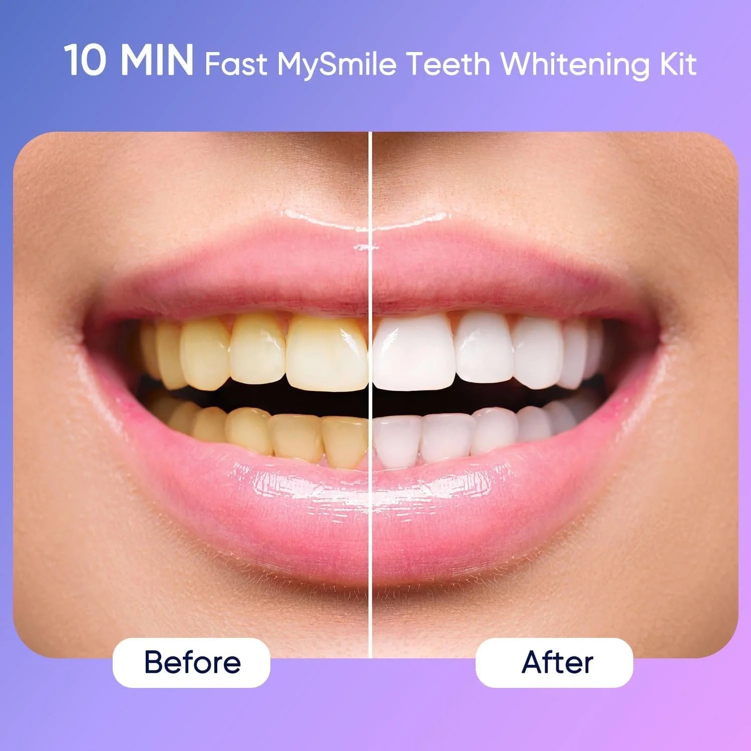 Ultimate Teeth Whitening Kit featuring a 28-LED whitening light